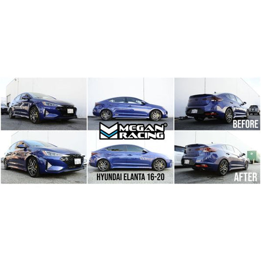 MR-CDK-HYE16S Installed on a Hyundai Elantra Sport